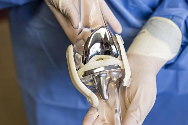 COMPLEX PRIMARY KNEE REPLACEMENT